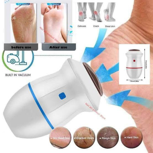 Foot Pedicure Grinder Dead skin Remover